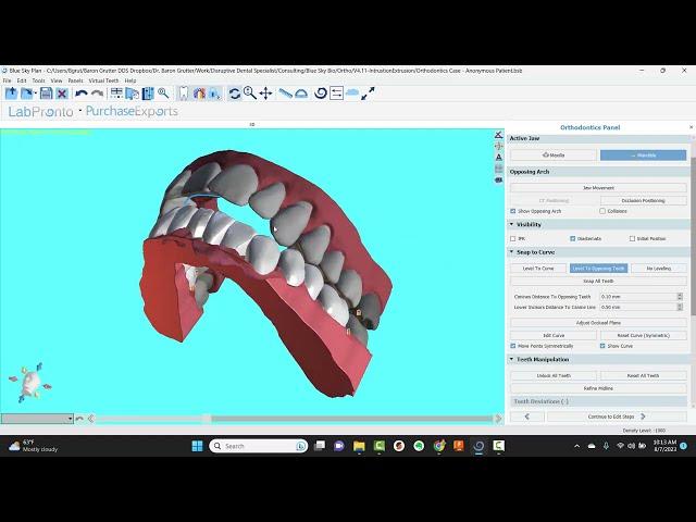 BlueSkyPlan Ortho: Automated Intrusion/Extrusion Alignment