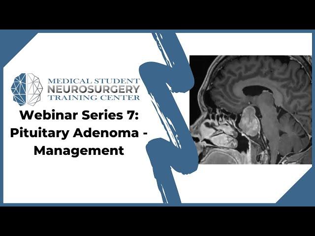 Webinar Series 7: Pituitary Adenoma - Management