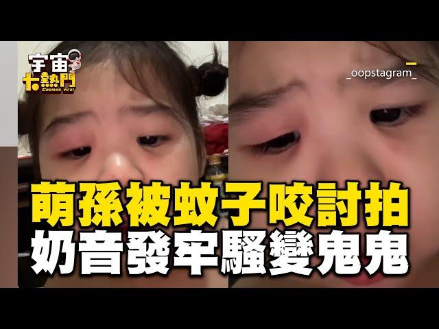 孫被蚊子咬跟阿嬤討拍！奶音發牢騷「變鬼鬼」萌翻@cosmosviral