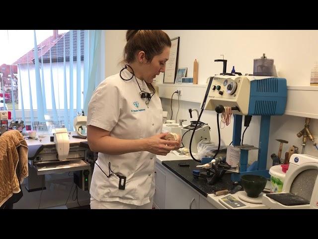 Herstellung einer Aufbiss Schiene im Labor