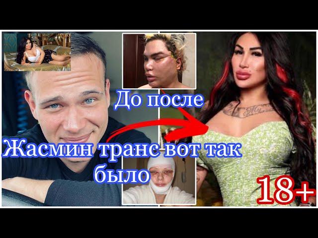 Жасмин транс до после как бил как стал 18+