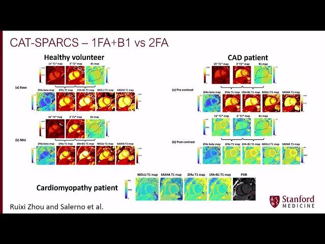 PlenarySession I 5 Trends in CMR  Highlights of SCMR 2022   Presented by Michael Salerno