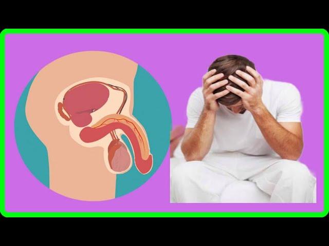 ERECTILE DYSFUNCTION HAMI YARIDA KACSIGA SARIRITA RAGA WAJAHDE GALMADA WAXA KEYNA DR. MAHAMED LIBAN