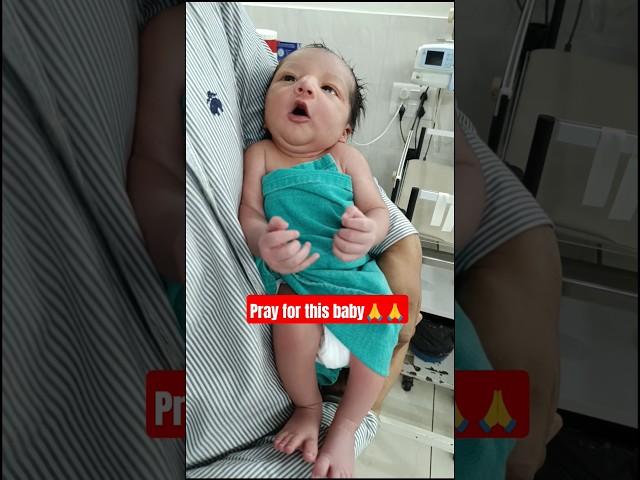 baby boy suffering neonatal jaundice  disease |#baby #doctor #niculife