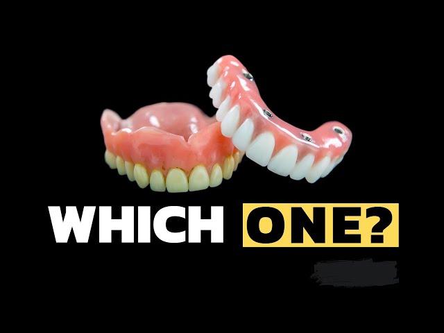 Epic Showdown: Dentures vs. Snap-ins vs. All on 4®!