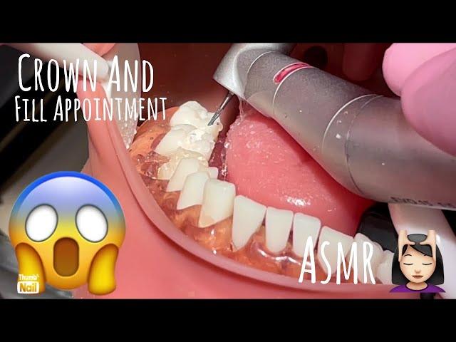 ASMR | REAL DENTAL OFFICE | Crown and Filling Dentist Appointment | Realistic Tooth Model