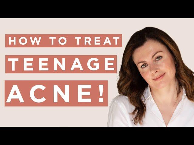 How To Treat Teen Acne | Dr Sam Bunting