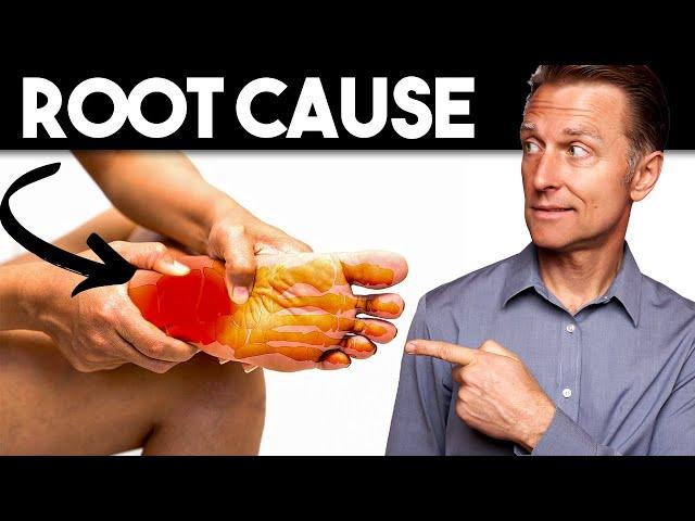 Peripheral NEUROPATHY (Root Cause and Best Remedy) — Dr. Berg