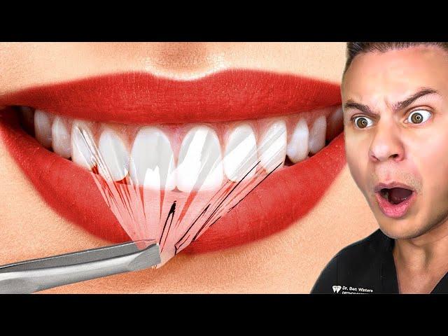 Orthodontist Busts DUMBEST Dental Myths