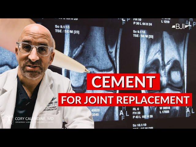 Cement Use for Knee Replacement Surgery