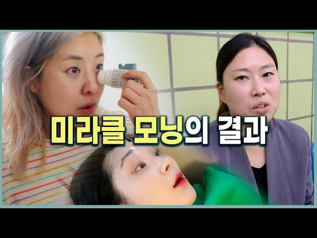 [생로병사의 비밀] 미라클모닝의 부작용