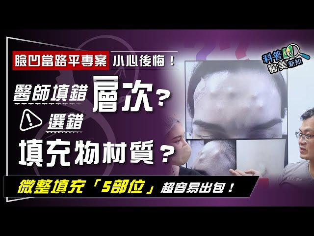 "微整控"注意！玻尿酸填淚溝  黑眼圈卻更嚴重？　盤點微整形填充容易「凹凸不平」的5雷區 科普醫美新知 346-20240419