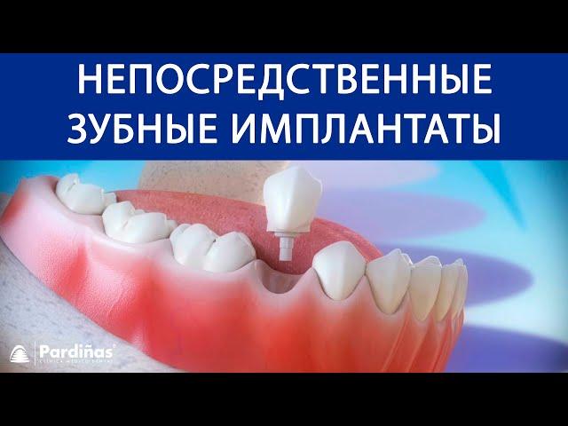 Непосредственные зубные имплантаты после удаление зуба ©