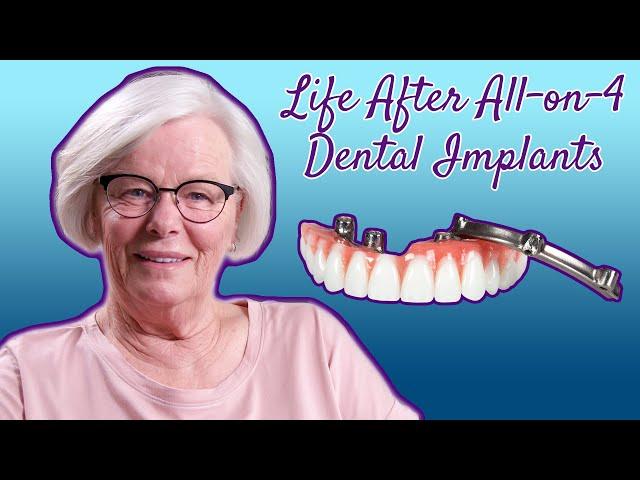 Life After All on 4 Dental Implants - 8 Months Post Surgery