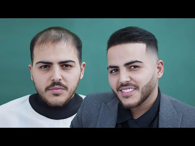 Witness the Magic l Barbers' Transformations Using Hair Powder Fibers