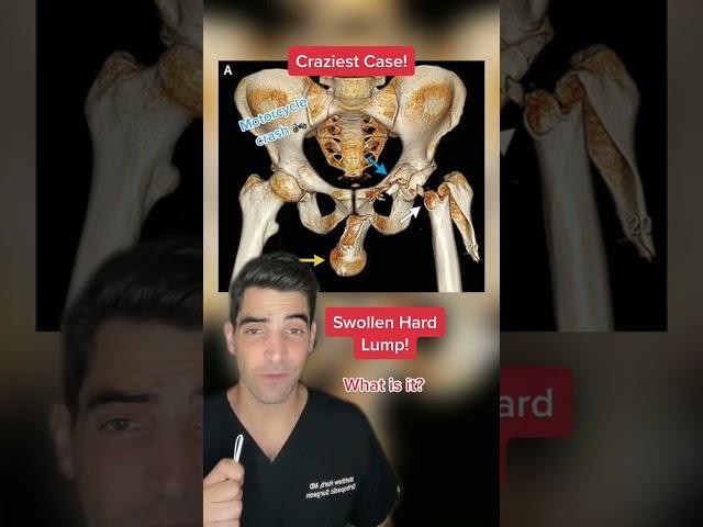 Orthopedic surgeon reacts to crazy orthopedic surgery cases