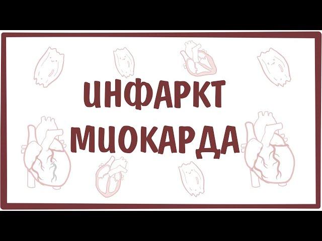 Инфаркт Миокарда