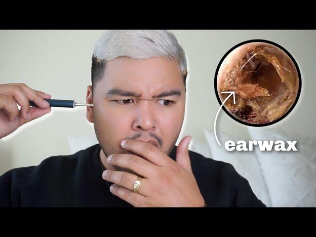 Using An Earwax Cleaning Camera For The First Time | alantimoteov