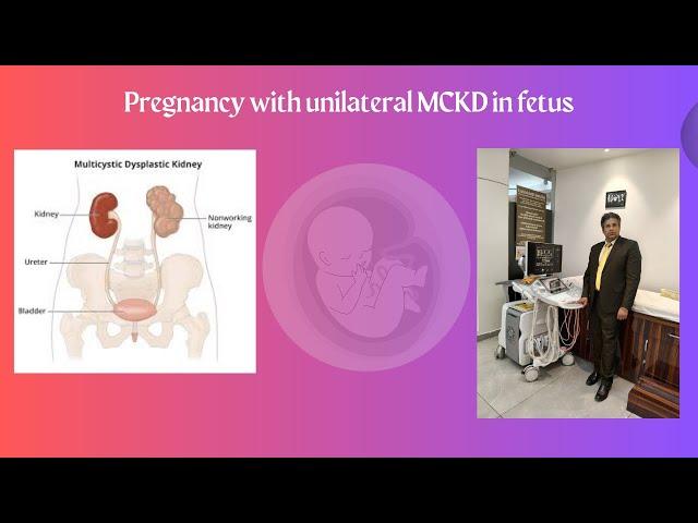 Pregnancy with unilateral MCKD in fetus