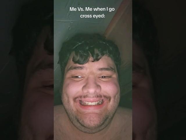 Me Vs. Me when I'm cross-eyed