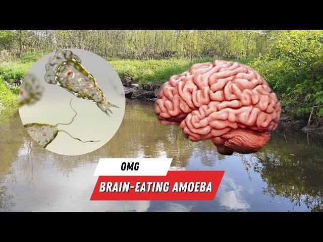 Israel Treats First Living Brain-Eating Amoeba Patient