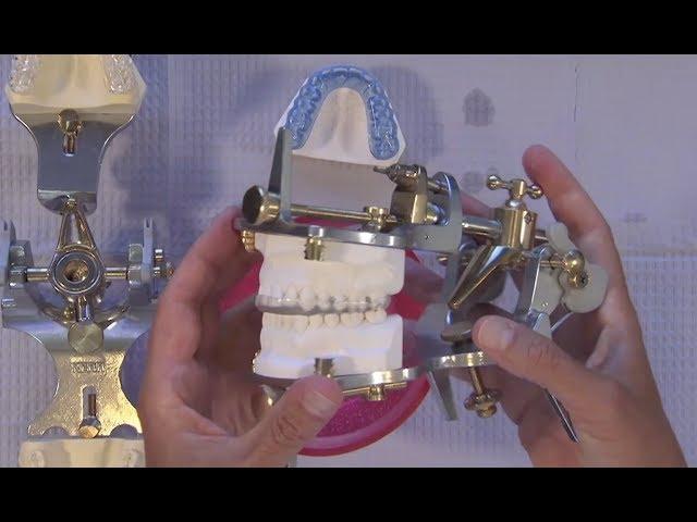 Case of the Week: Occlusal Splints