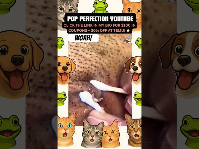 Wow! #pimplepopping #pimple #pimples #shortsfeed #shortvideo #shorts #short #youtube #youtubeshorts