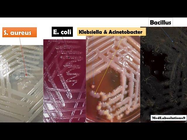 Most Common Bacterial Colony Morphology/ E. coli/Klebsiella/Pseudomonas/Proteus/Staphylococcus/Baci