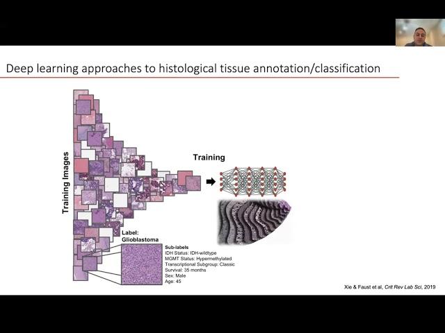 Artificial Intelligence in Pathology: Implementation Strategies - Dr. Phedias Diamandis