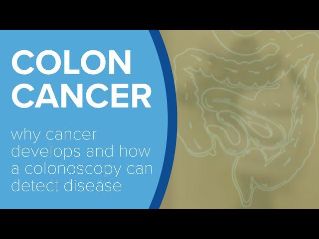 How Colon Cancer Develops - Yale Medicine Explains