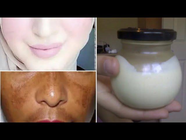 Skin whitening treatment that works 100% / get fair skin naturally