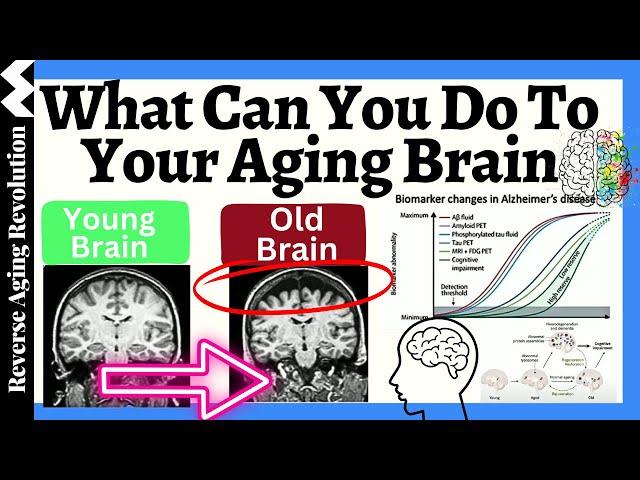 What Can You Do To YOUR AGING BRAIN? 12 Ways To Keep Your Brain YOUNG & New Advances