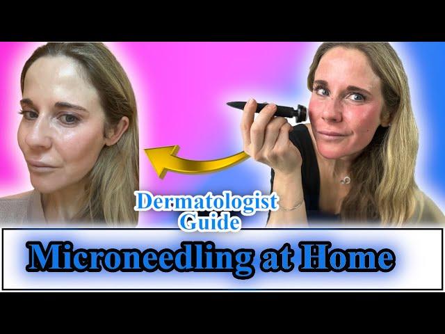 How to do Microneedling at Home: Dermatologist Guide