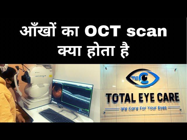 Eye Ka OCT scan kya hota hai| Total Eye Care| Kolkata