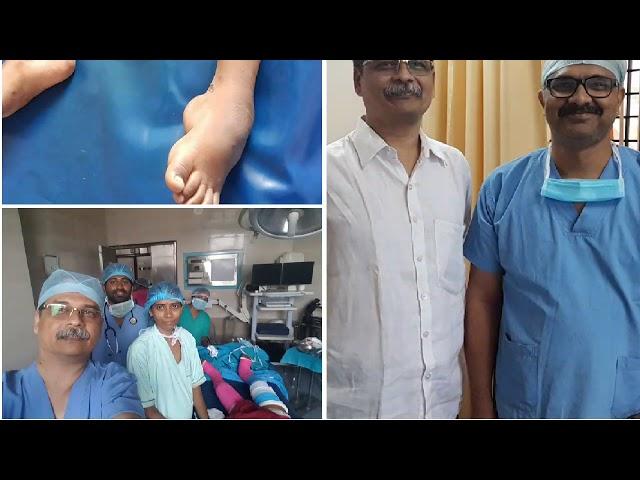 Corrective surgery, Adamya Hospital and Ortho Care Centre gadag videos