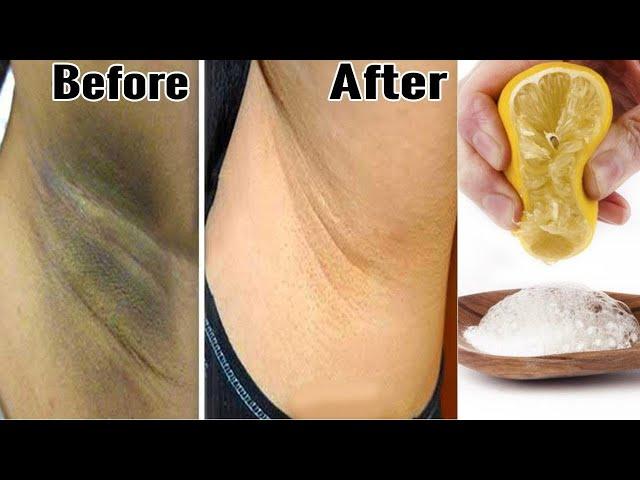 Baking Soda for Underarm Whitening - Dark Underarms Home Remedy