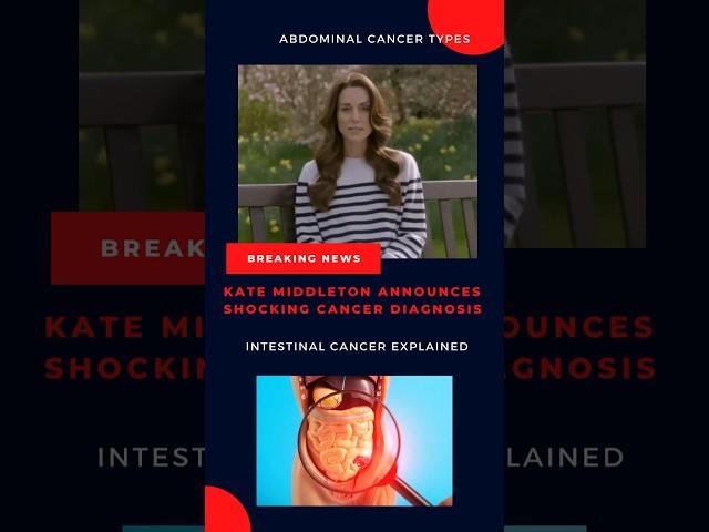 Intestinal Cancer / Abdominal Cancer 2 SYMPTOMS #intestinalcancer #cancer #intestines #abdominal