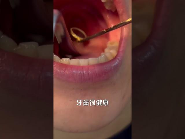 看耳鼻喉科結果只知道牙齒很健康 #medicalstudent