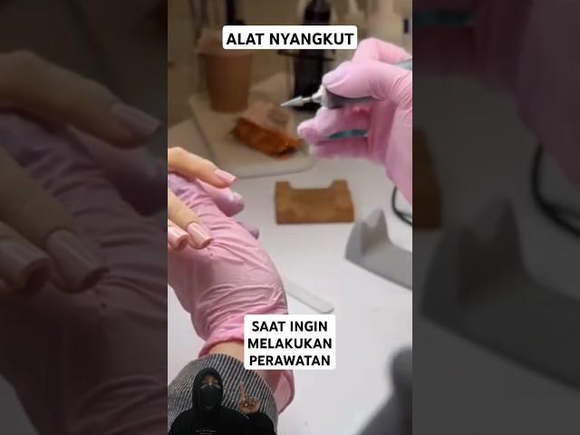 Alat Nyangkut Saat Ingin Melakukan Perawatan Pasiennya