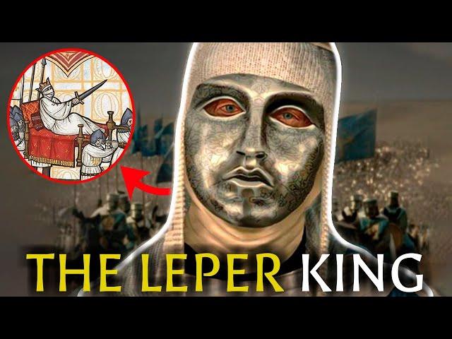 Baldwin IV of Jerusalem: The Leper King | The Crusades