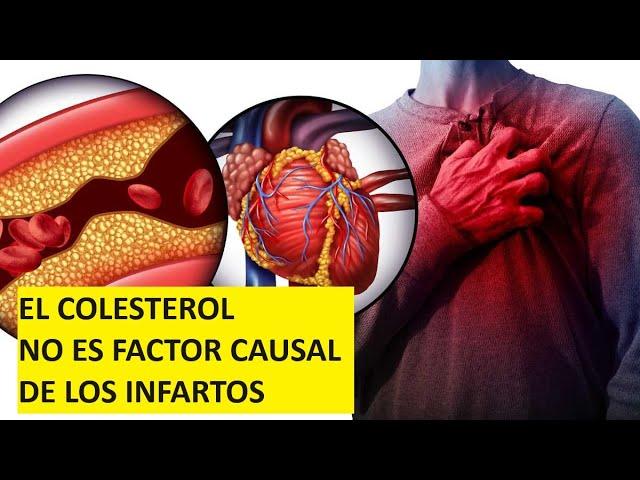 El Colesterol NO es factor CAUSAL de los infartos