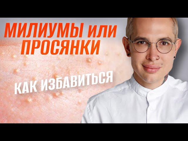 МИЛИУМЫ или ПРОСЯНКИ как избавиться в домашних условиях #подкожники #просянки