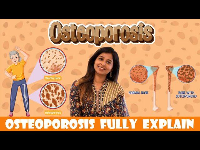 Osteoporosis fully Explained by @Dr.Sharmika | #drsharmika #rheumatoid #bodypain