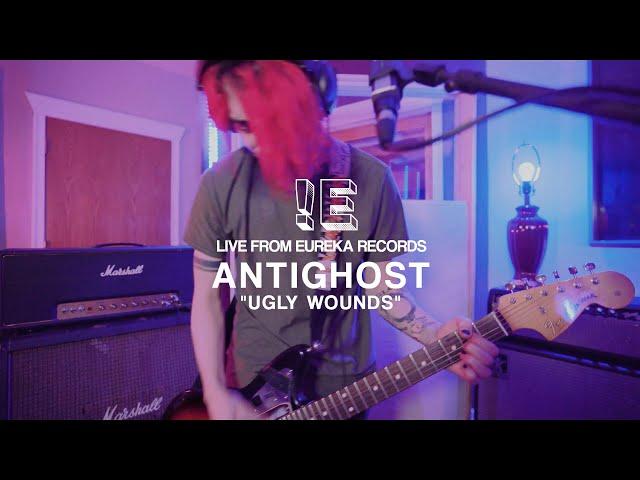 Antighost – "Ugly Wounds" – Live From Eureka Records