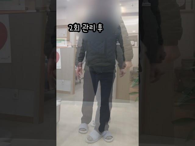 허리협착 수술 후 무릎 인공관절 수술 후유증
