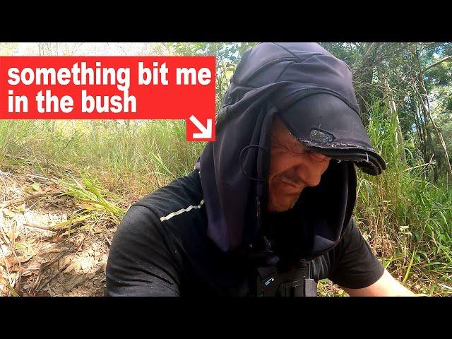 I was bitten by an AUSTRALIAN SPIDER // Here's what happened!!