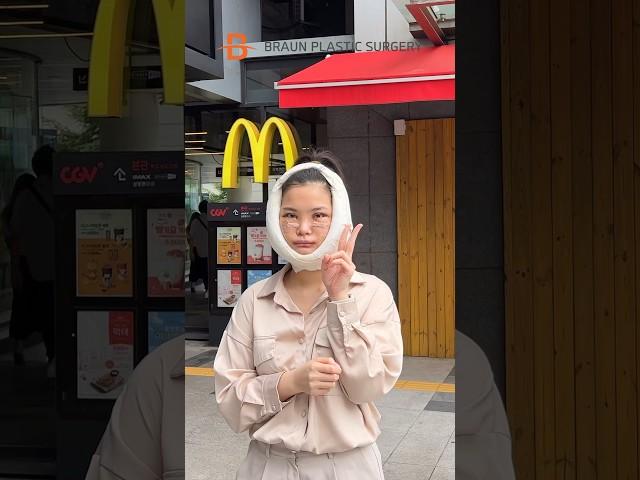 Looking so much younger after surgery️ #plasticsurgery  #beforeandafter #transformation