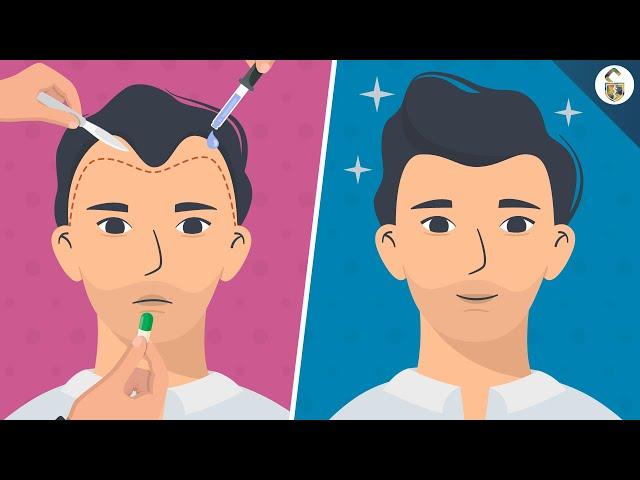 Hair Loss Treatments For Men (According To Science)