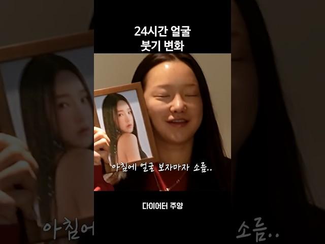 아침 저녁 붓기 차이 ㄷㄷ