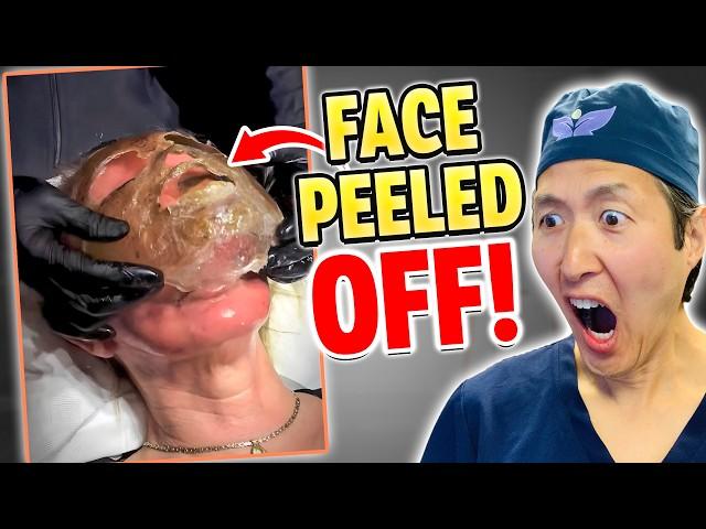 Peeling Off Faces with TOXIC Phenol! Plastic Surgeon Reacts!